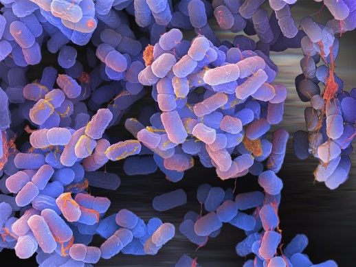 E-coli (1)
